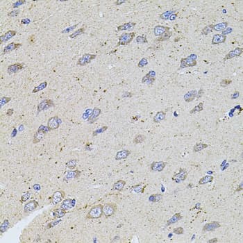 ALDH1A1 / ALDH1 Antibody