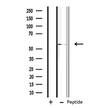 PSMD12 / Rpn5 Antibody