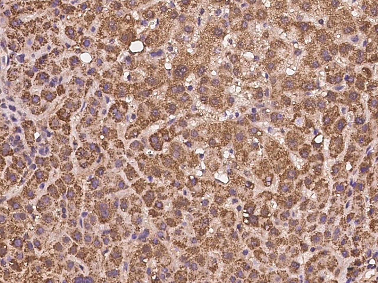 Polyclonal Rabbit anti-Human AMD / AMD1 Antibody (IHC)