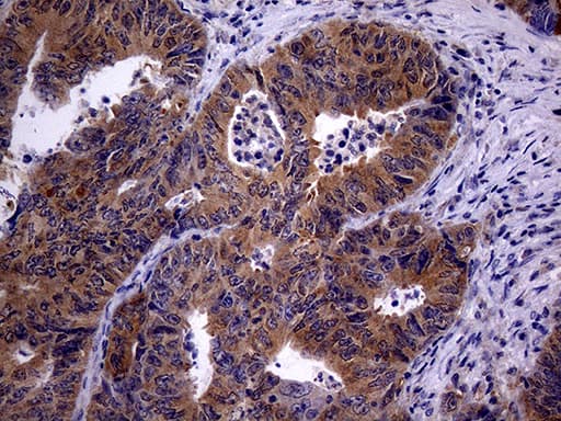 Monoclonal Mouse anti-Human TRIP13 Antibody (clone OTI2F5, aa31-148, IHC, WB)