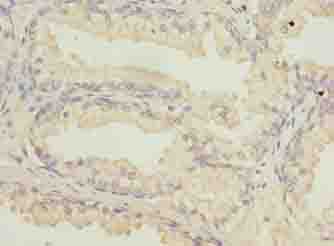 Polyclonal Rabbit anti-Human ATL2 Antibody (IHC, WB)