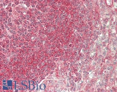 TEAD2 Antibody (aa323-372)