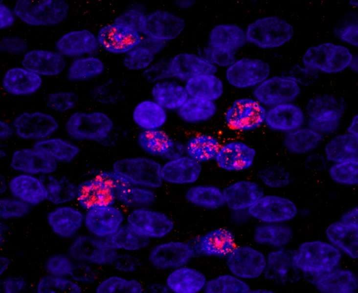 Polyclonal Rabbit anti-Human ZHX3 Antibody (aa150-200, IHC, IF)