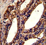 TMEM142A / ORAI1 Antibody (aa145-173)