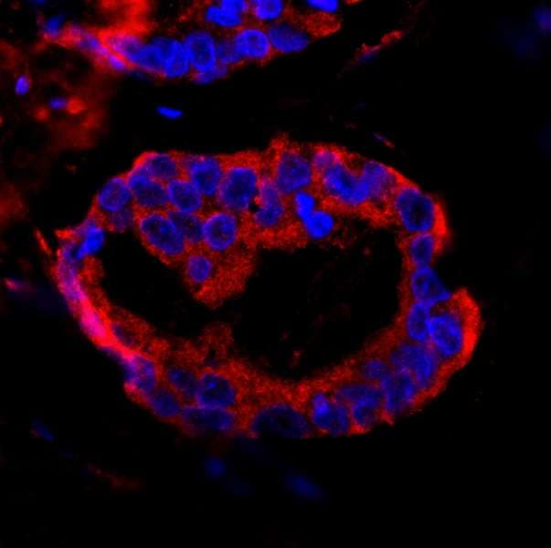 CC2D1A Antibody (aa1-50)