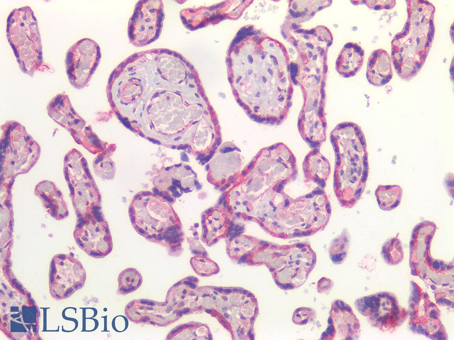 PathPlus™ CTNNB1 / Beta Catenin Antibody