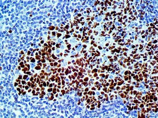BCL6 Antibody