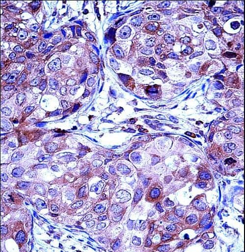 MMP13 Antibody (aa253-282)