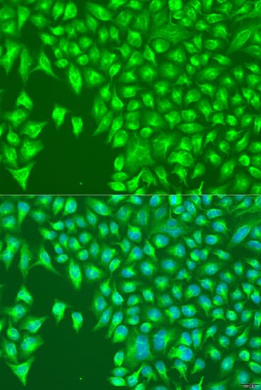 KIR2DS4 Antibody