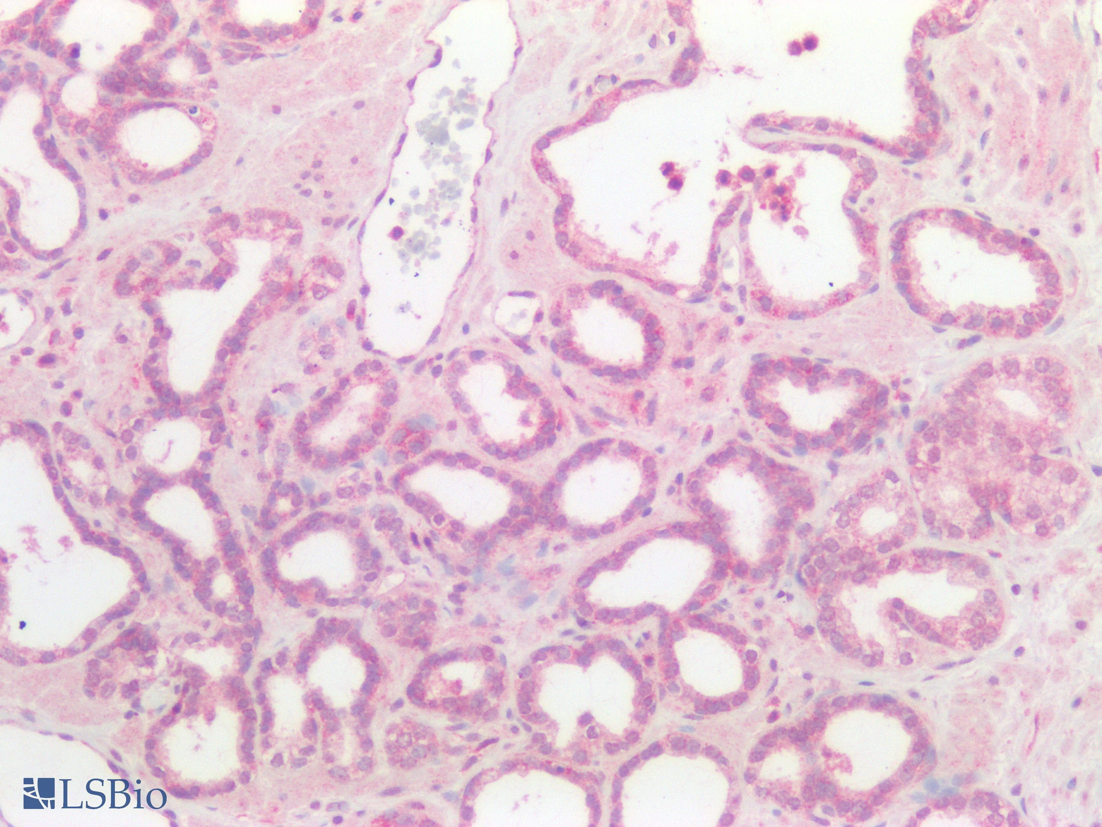 PathPlus™ Polyclonal Rabbit anti-Human GNAQ Antibody (IHC)