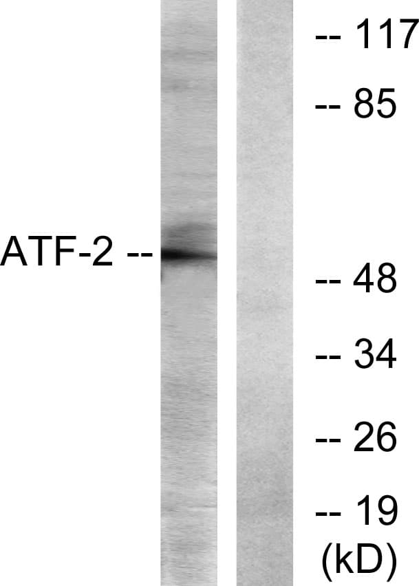 ATF2 Antibody (aa40-89)