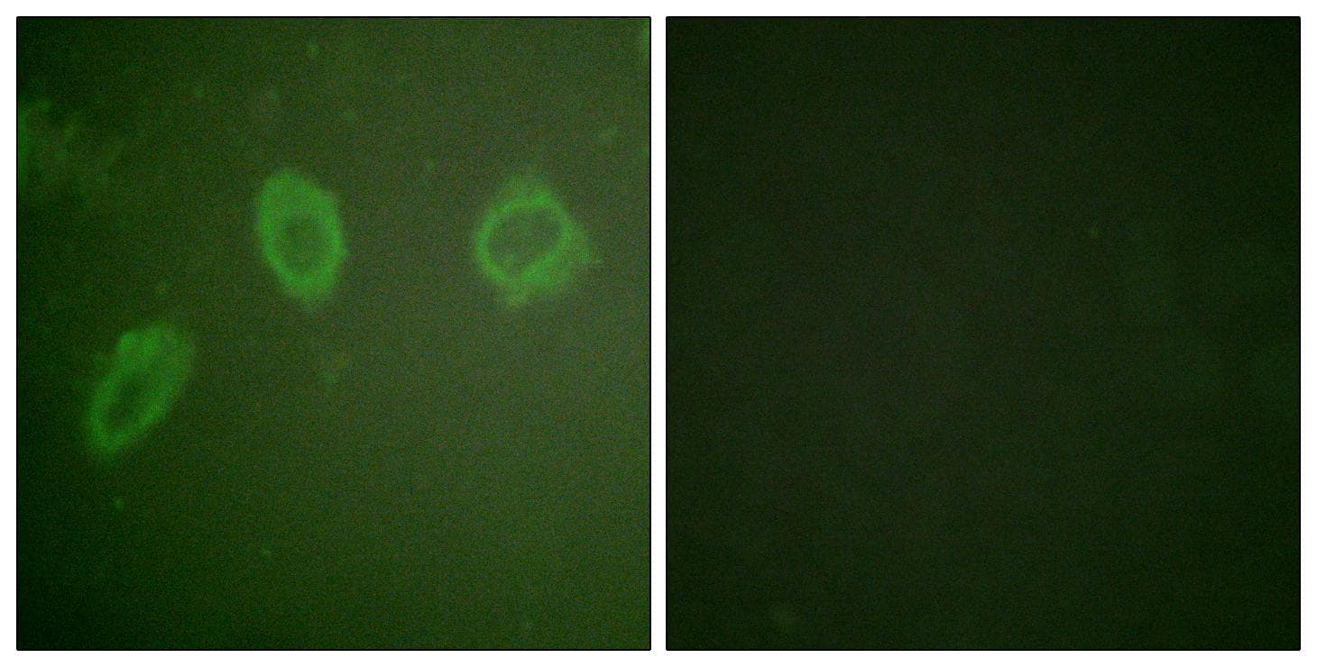 Polyclonal Rabbit anti-Human ERBB2 / HER2 Antibody (Ab-686, IF)