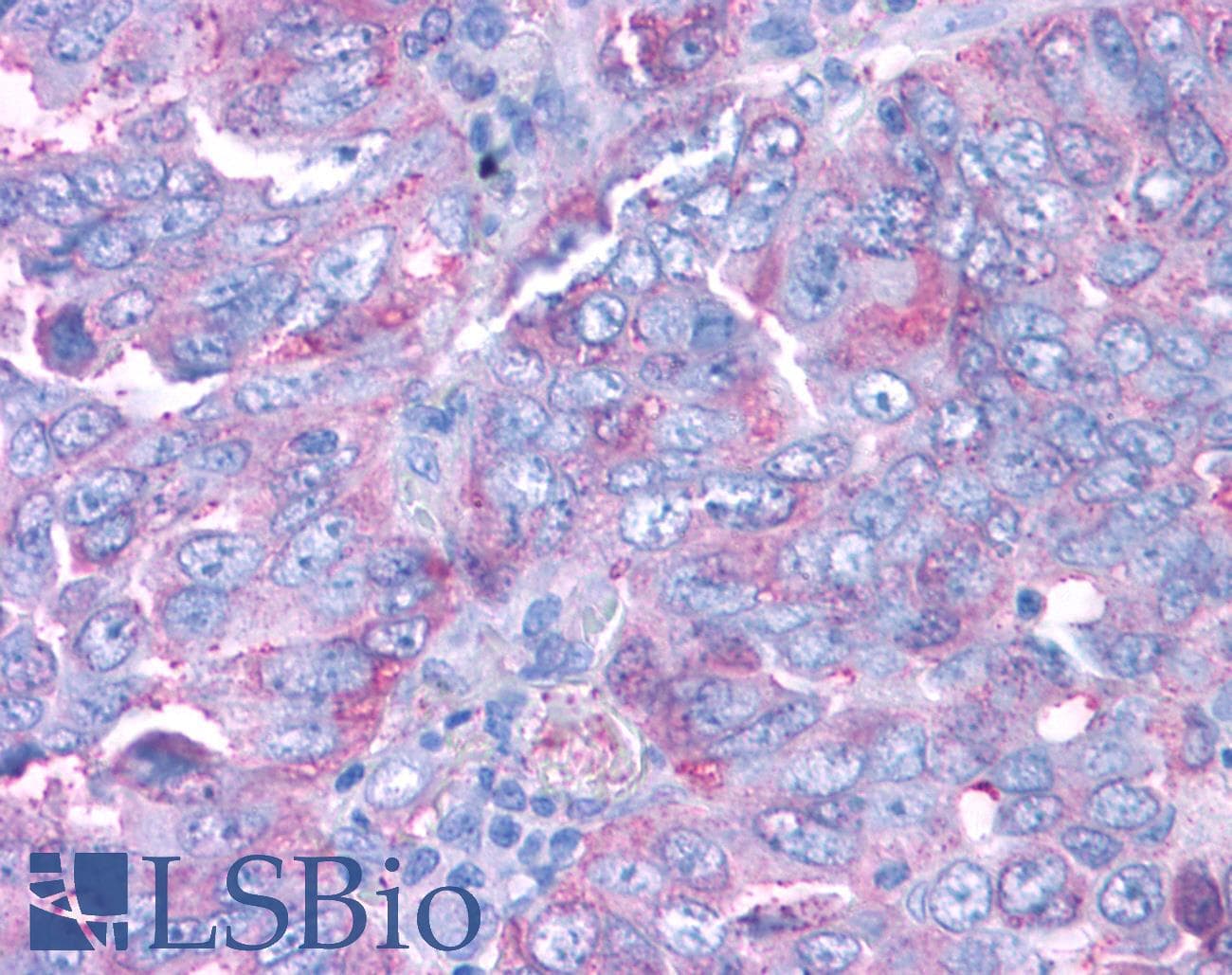 PathPlus™ PKD3 / PRKD3 Antibody (Internal)