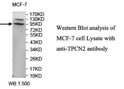 TPC2 / TPCN2 Antibody (N-Terminus)