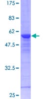 Human RAB8A / RAB8 Protein (Recombinant GST)