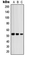 Polyclonal Rabbit anti-Human PRKAR2B Antibody (Internal, IHC, WB)