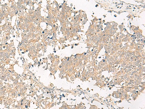 GPR161 Antibody