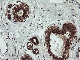 TRMT2A Antibody (clone OTI1C3)