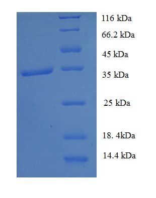Human GTF2H5 Protein (Recombinant GST)