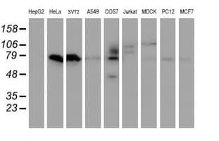IHC-plus™ Monoclonal Mouse anti-Human VWA5A Antibody (clone 3A3, IHC, IF, WB)