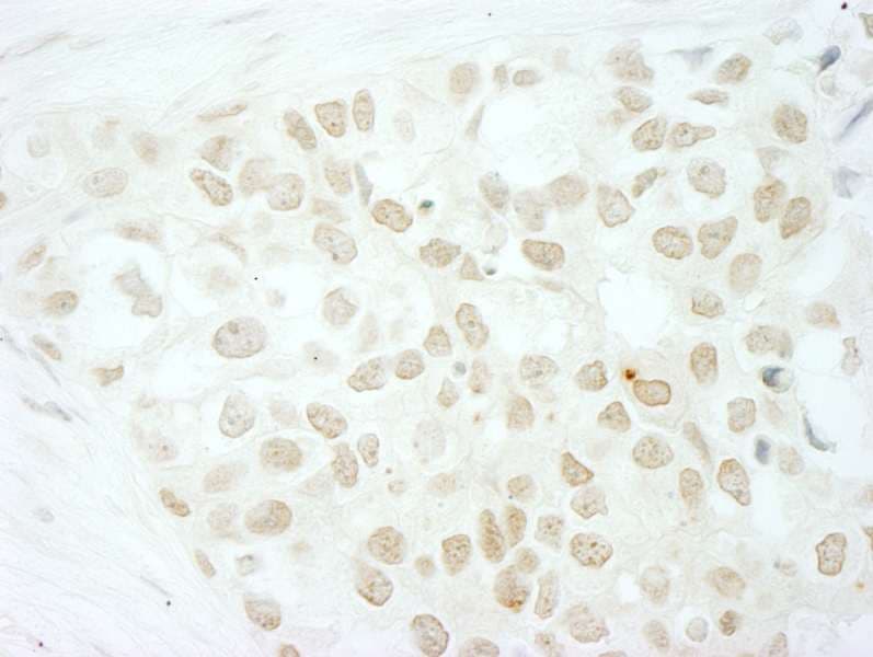 Polyclonal Rabbit anti-Human MKRN2 Antibody (aa366-C-term, IHC, WB)