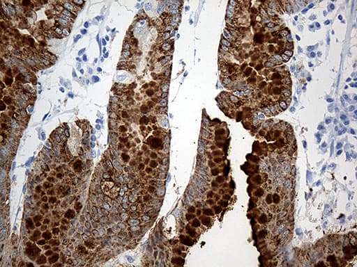 TFF1 / pS2 Antibody (aa25-84, clone OTI1F5)