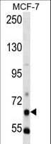 Polyclonal Rabbit anti-Human PCK1 Antibody (aa40-70, IHC, WB)