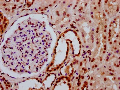 Polyclonal Rabbit anti-Human HIST1H3A Antibody (IHC, WB)