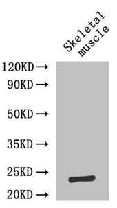 IL6 / Interleukin 6 Antibody
