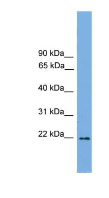 JUNDM2 / JDP2 Antibody (C-Terminus)