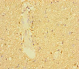 SLC6A7 Antibody