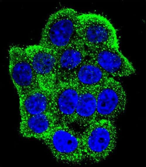 Polyclonal Rabbit anti-Human Hamartin / TSC1 Antibody (aa401-430, IHC, IF, WB)