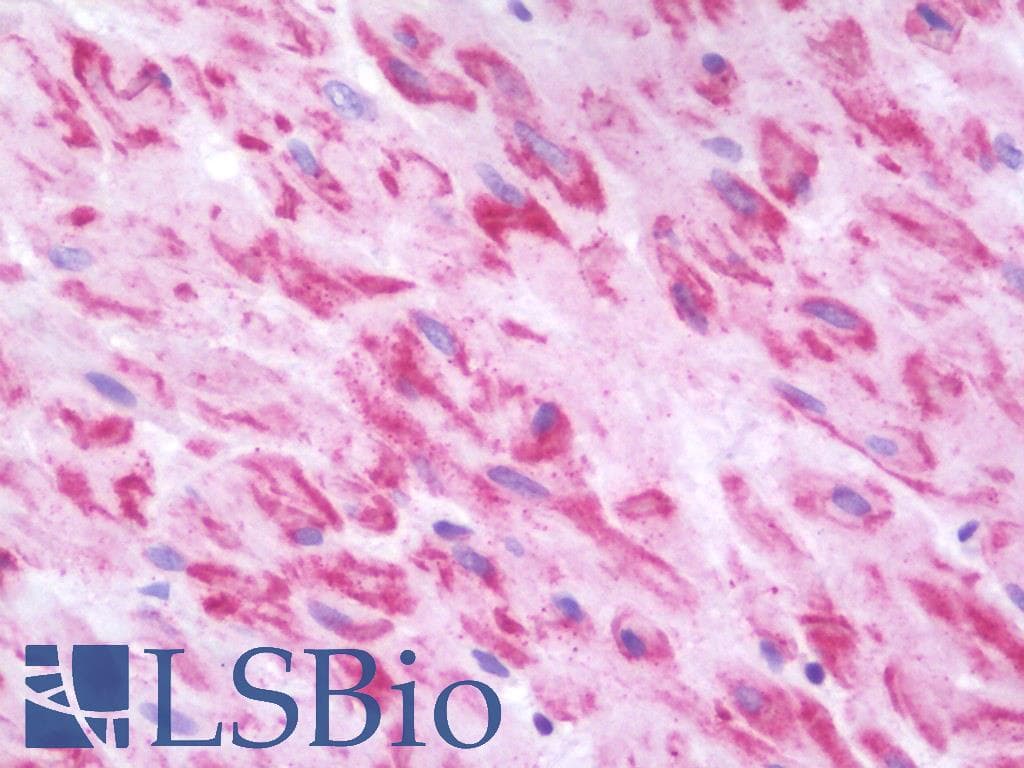 IHC-plus™ Polyclonal Rabbit anti-Human MYH14 Antibody (aa1051-1100, IHC, WB)