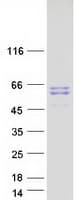 Human D2HGDH Protein (Recombinant Myc-DDK (Flag))