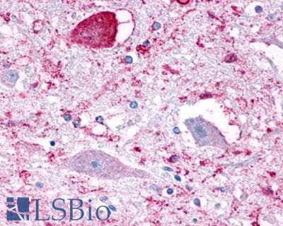 PathPlus™ NPFFR1 / GPR147 Antibody (Extracellular Domain)