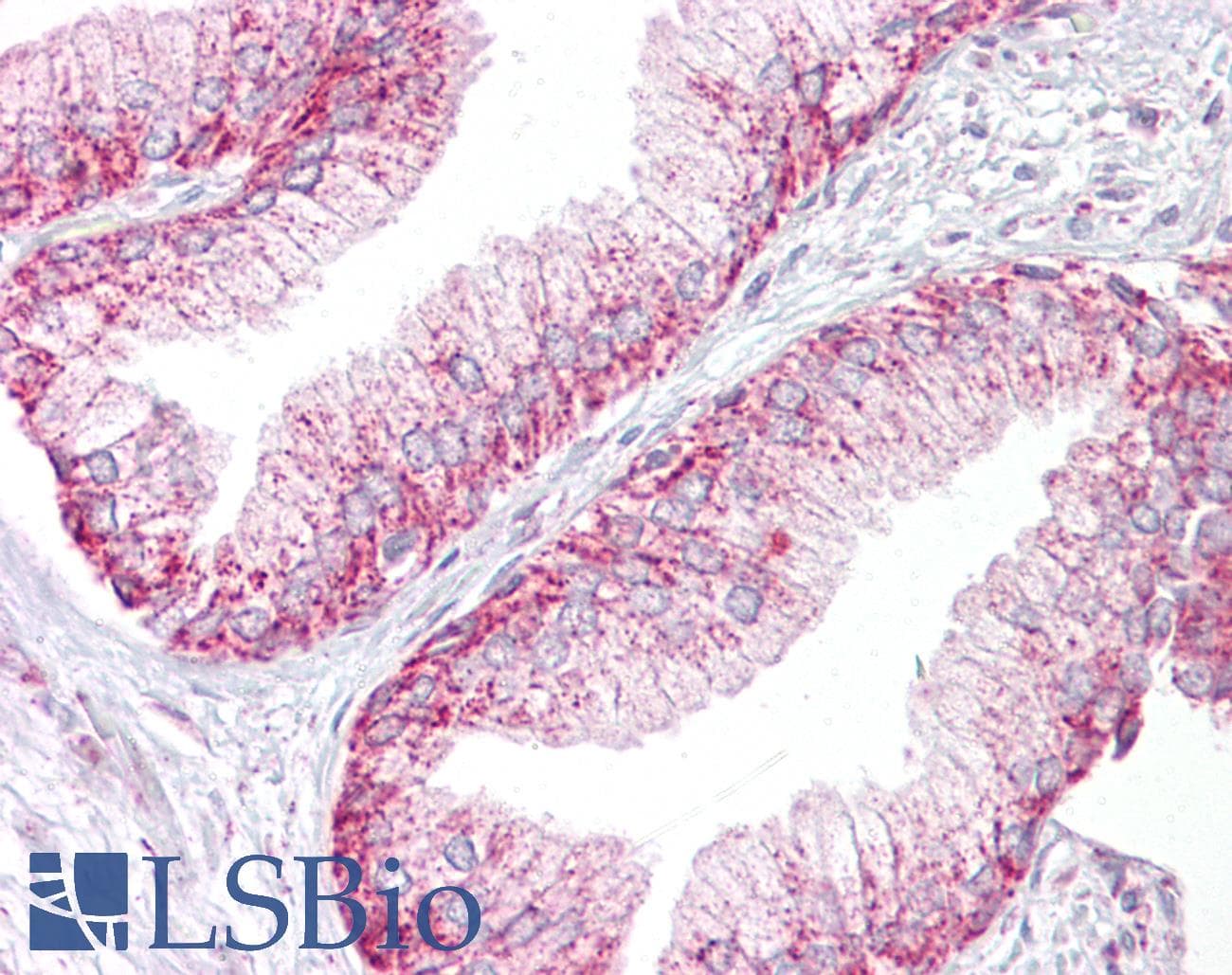 Polyclonal Rabbit anti-Human AURKA / Aurora-A Antibody (C-Terminus, IHC, WB)