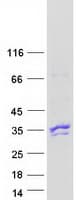 Human VAV3 Protein (Recombinant Myc-DDK (Flag))