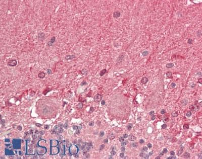 IHC-plus™ OGT / O-GLCNAC Antibody
