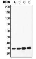Polyclonal Rabbit anti-Human APOA1 / Apolipoprotein A 1 Antibody (Internal, WB)