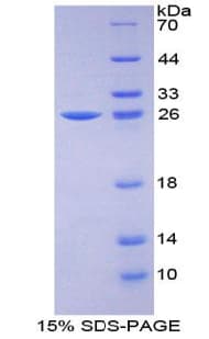 Human IGFBP1 Protein (Recombinant His-T7)