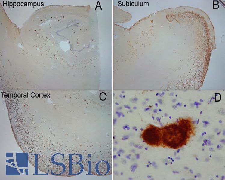 Amyloid Fibrils Antibody (PerCP)