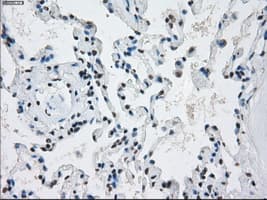 Monoclonal Mouse anti-Human PRKY Antibody (clone OTI4G7, Carrier-free, IHC, IF, WB)