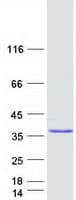 Human ANKRD49 Protein (Recombinant Myc-DDK (Flag))