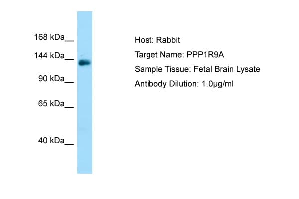 PPP1R9A / Neurabin 1 Antibody (C-Terminus)