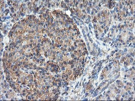 TUBAL3 Antibody (aa150-446, clone OTI2F6, Carrier-free)
