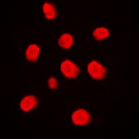 MAP3K3 / MEKK3 Antibody (Internal)