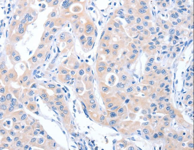 ARHGEF6 Antibody