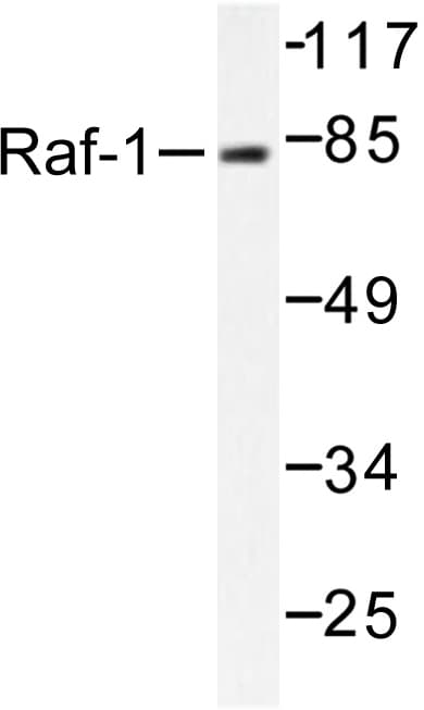 Polyclonal Rabbit anti-Human RAF1 / RAF Antibody (Gln253, IHC, WB)