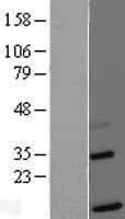 TIMM13 Protein (Over-Expression Lysate Myc-DDK (Flag))