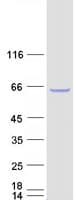 Human CDKN2AIP Protein (Recombinant Myc-DDK (Flag))